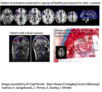 fMRI figure