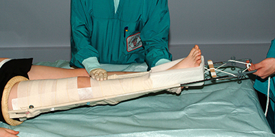 Patient lying on a bed with their bandaged leg being examined