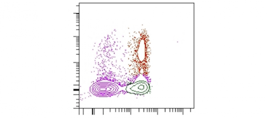 results diagram