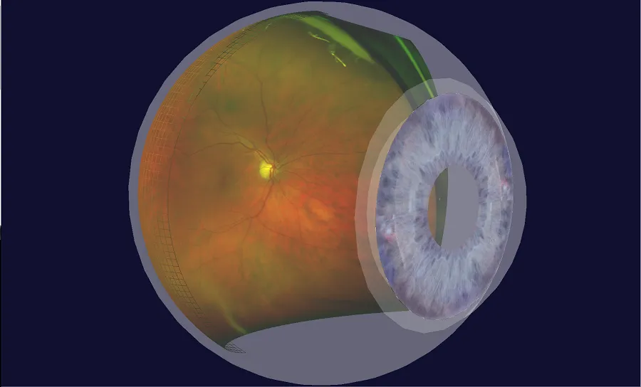 3D visualization of Retinal View