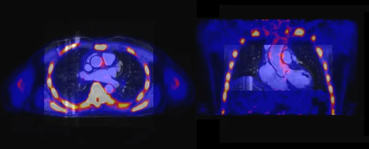 PET-MR reaches 200th scan article