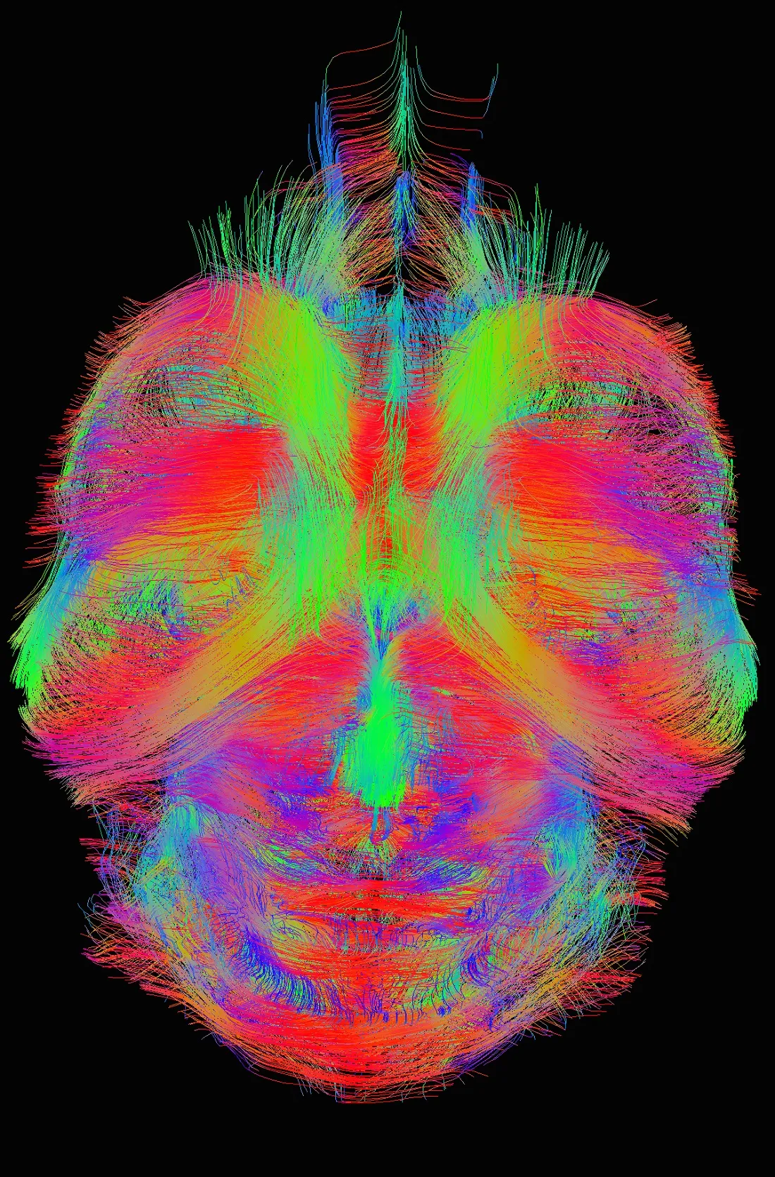 A 3D representation of the connections between neurons in the mouse brain, produced from a type of MR scan. Each line represents a bundle of axons which connects neurons into networks.