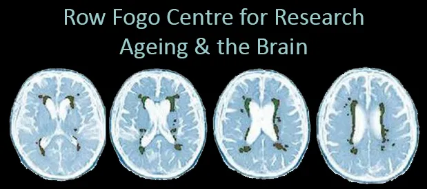 Row Fogo Centre for Research into Ageing & the Brain