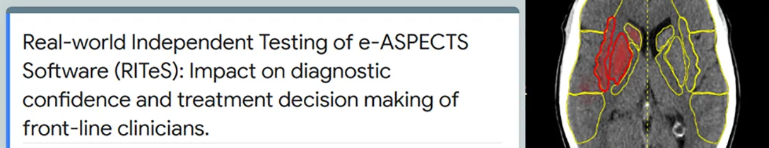 Real-world Independent Testing of e-ASPECTS Software (RITeS)