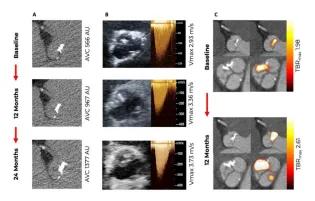 EIW_News_20211018_EI radiochemistry SALTIRE II