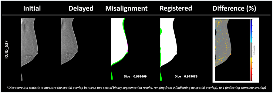 Initial and delayed CESM images