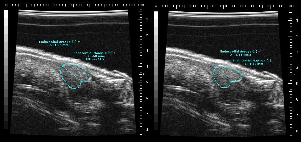 ultrasound image of adult fish heart