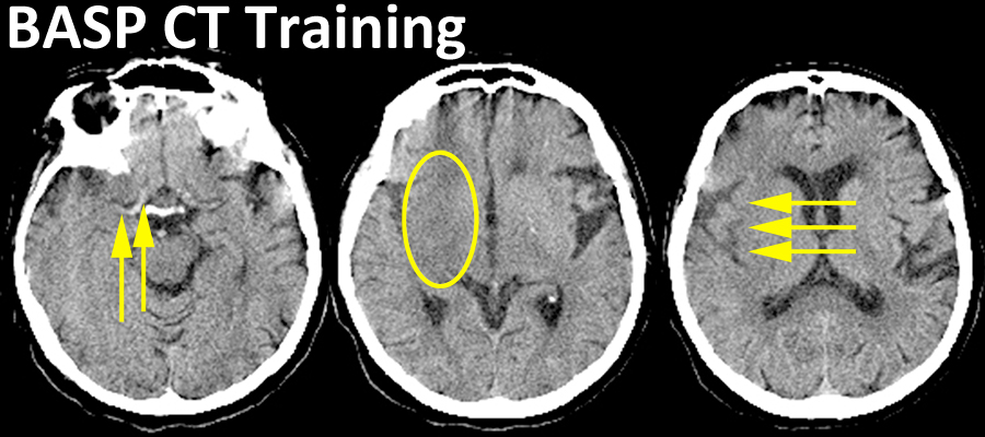 BASP CT Training