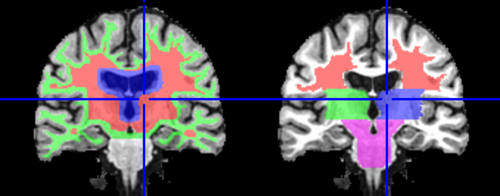 Digital brain atlas