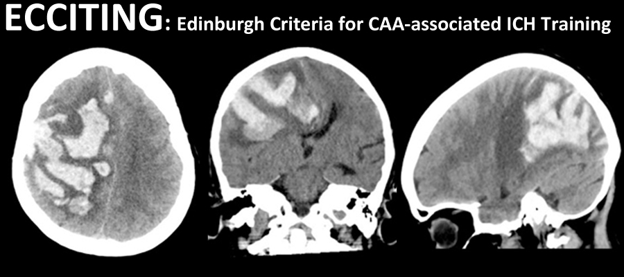 Edinburgh Criteria for CAA-associated ICH Training (ECCITING ...