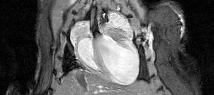 LateGd MRI of mouse heart