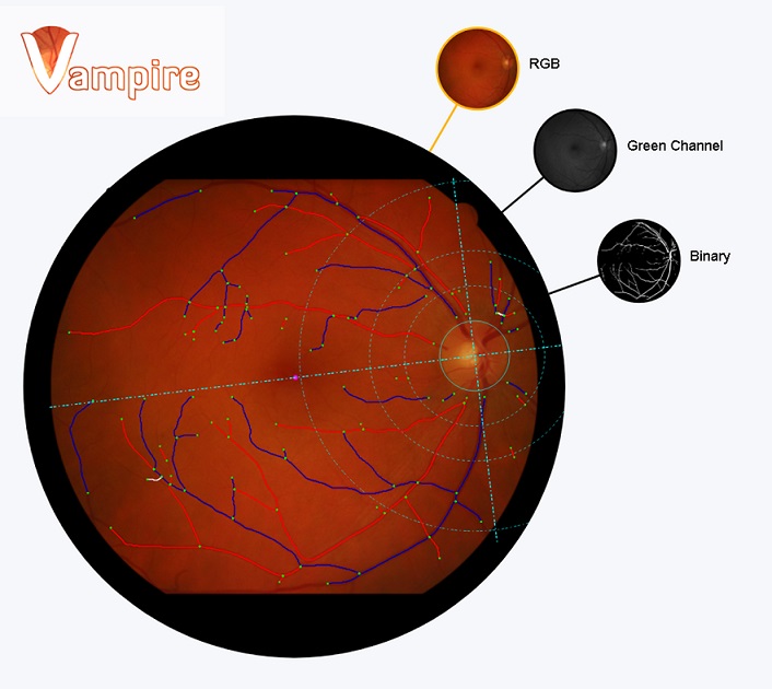 Retinal Imaging