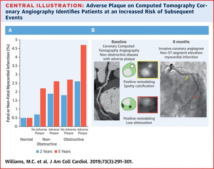 Featured paper - SCOT HEART