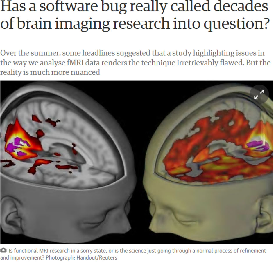 Brain Imaging fMRI