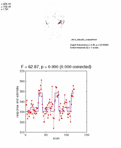 20 years fMRI article - SPM