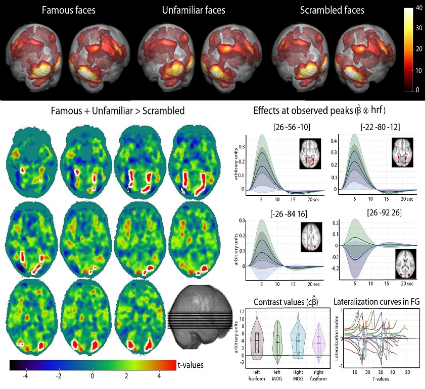 fMRI illustration of activations for faces 