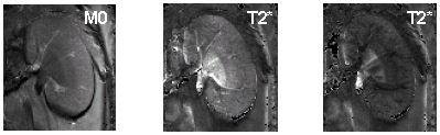 Mouse kidney MRI