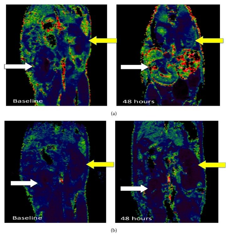 USPIO-enhanced MRI of a mouse kidney