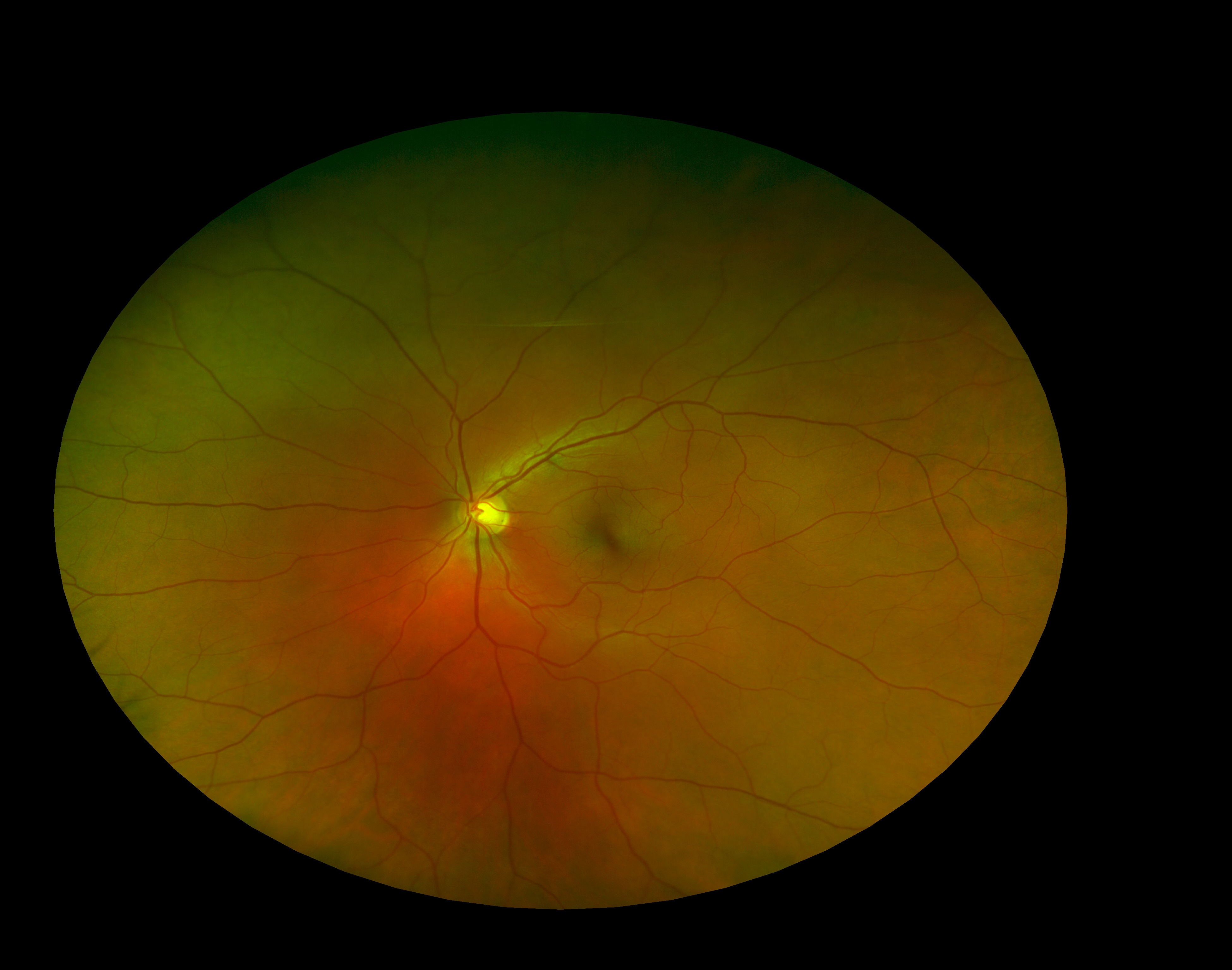 Retinal Image