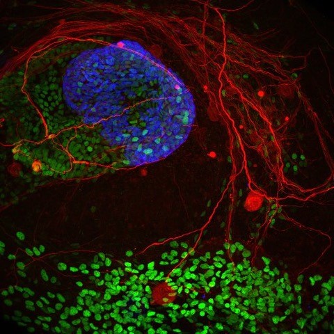 Skin organoid