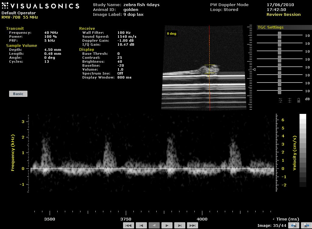 ultrasound image of 4-day old fish heart