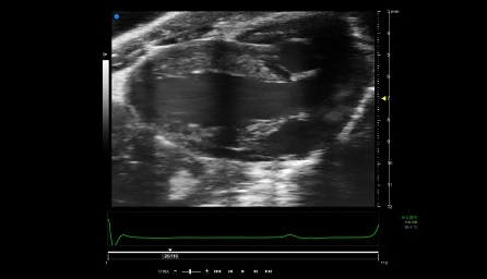 Figure 1: High resolution image of left ventricle on adult mouse heart